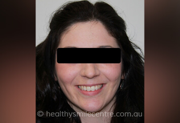 34d486_60a01f4fe72145d29a085e359b82e560_mv2 | Healthy Smile Centre Rosebery Healthy Smile Centre 2